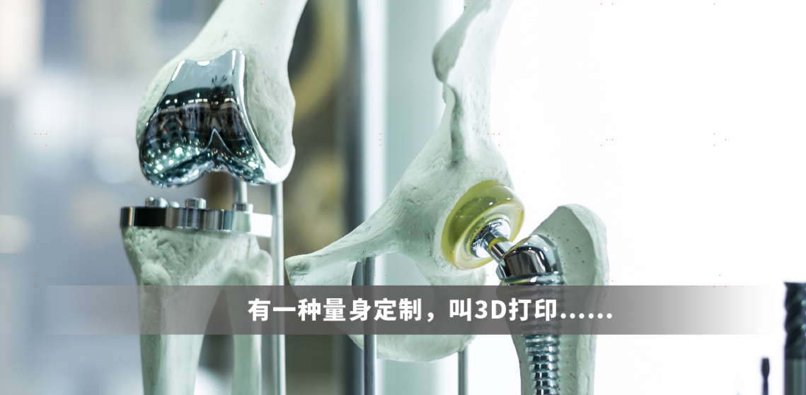 有一种量身定制，叫3D打印……