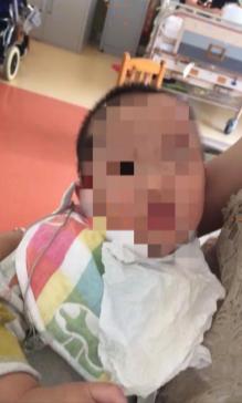 如何处理婴幼儿发烧?这位母亲的处理方式,毁了孩子的一生